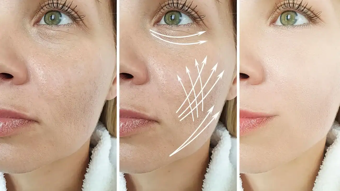 Can One Treatment Really Tackle More Than One Skin Concern Thrapston?