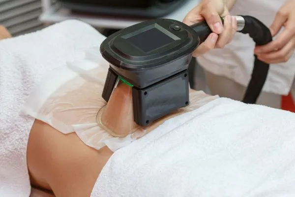Image of person having fat freezing treatment to help weight gain Thrapston