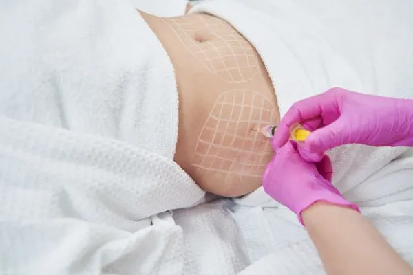 image of fat dissolving injections on love handles to help combat weight gain Thrapston
