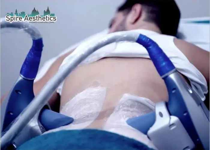 Man having fat freezing treatment done on love handles before a competitions Thrapston to create a sculpted look.