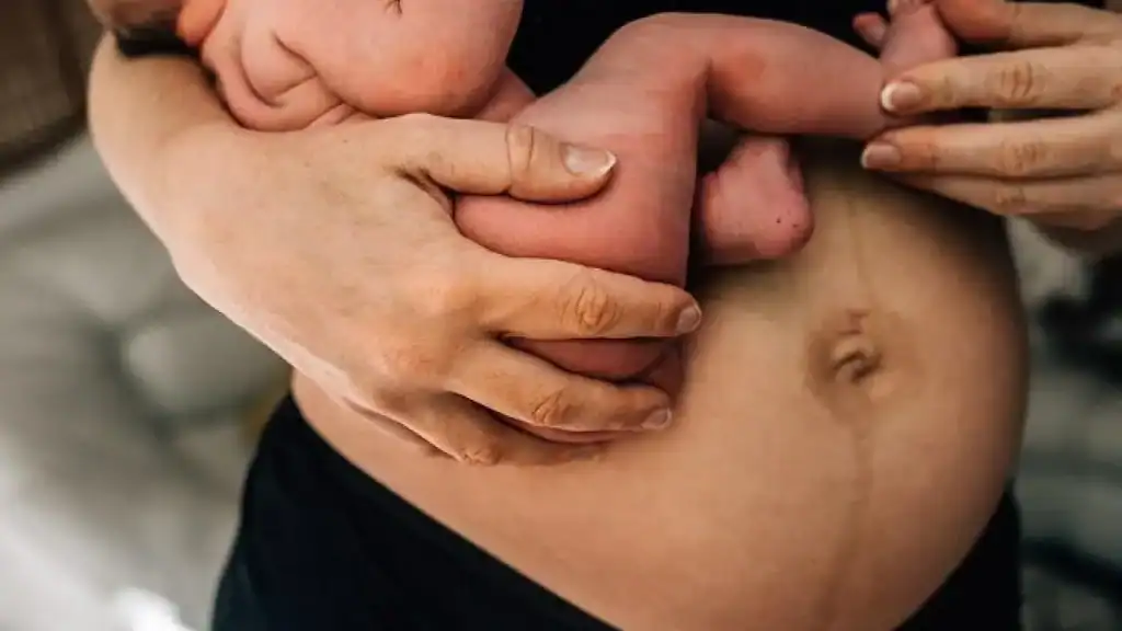 Why Is My Stomach Still Big After Pregnancy Thrapston?